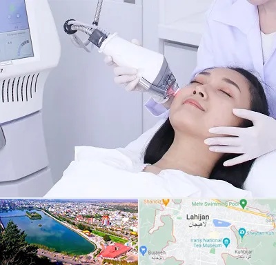 وایتنینگ در لاهیجان