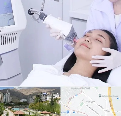 وایتنینگ در شهر زیبا 