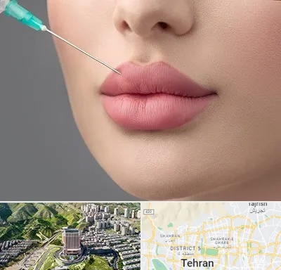 کلینیک ژل لب روسی در شمال تهران 
