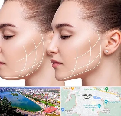 جراحی بوکال فت در لاهیجان