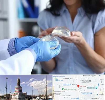 پروتز باسن در کارگر جنوبی 