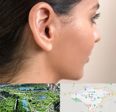 عمل گوش بل در بجنورد