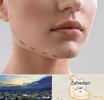 عمل زاویه فک در زاهدان