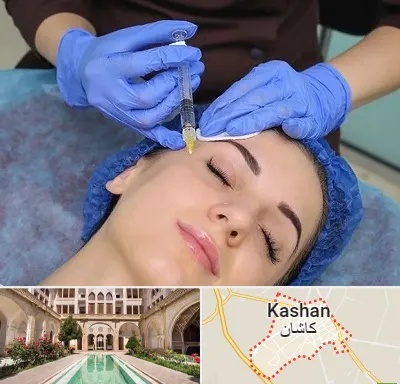 تزریق پروفایلو در کاشان