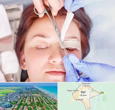 جراحی پلک افتاده در ساری