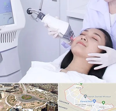 وایتنینگ در پرند