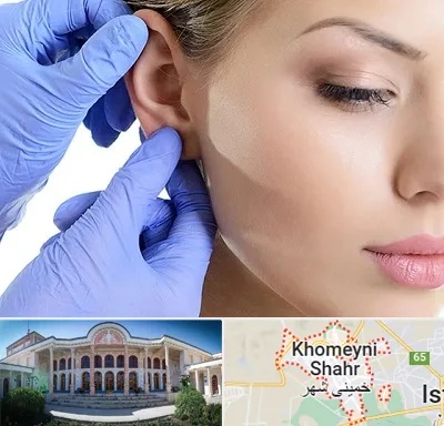 اتوپلاستی در خمینی شهر