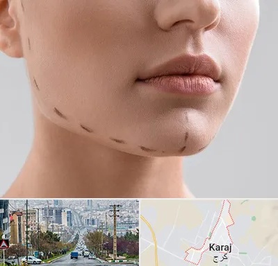 عمل زاویه فک در گوهردشت کرج 