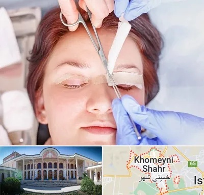 جراحی پلک افتاده در خمینی شهر