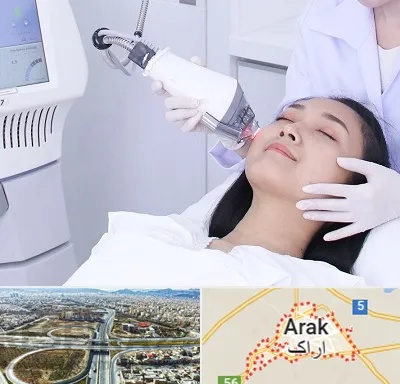 وایتنینگ در اراک