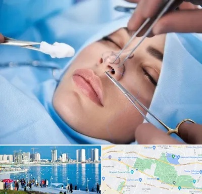 عمل ترمیمی بینی در چیتگر 