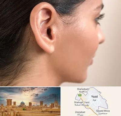 عمل گوش بل در یزد