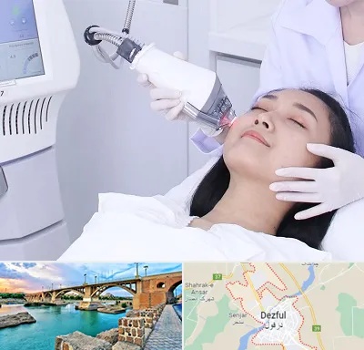وایتنینگ در دزفول