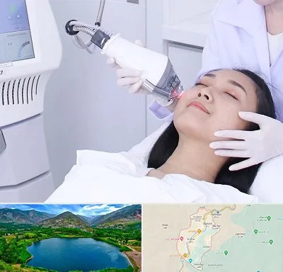 وایتنینگ در رودبار