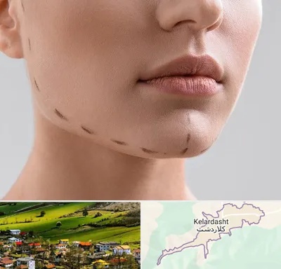عمل زاویه فک در کلاردشت