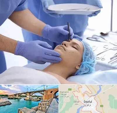 عمل بینی طبیعی در دزفول