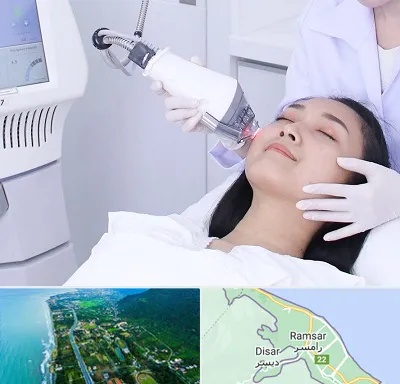 وایتنینگ در رامسر