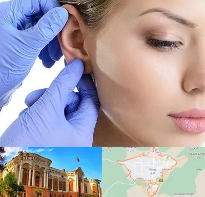 اتوپلاستی در خوی