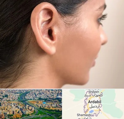 عمل گوش بل در اردبیل