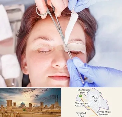 جراحی پلک افتاده در یزد