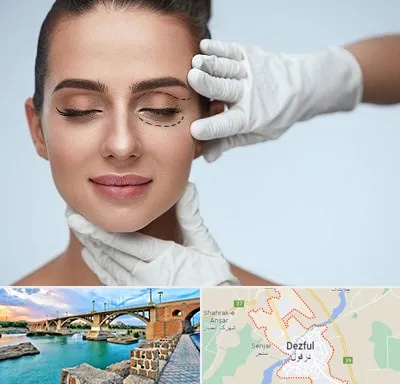 عمل پف چشم در دزفول