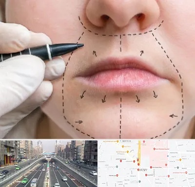 عمل سانترال لب در توحید 