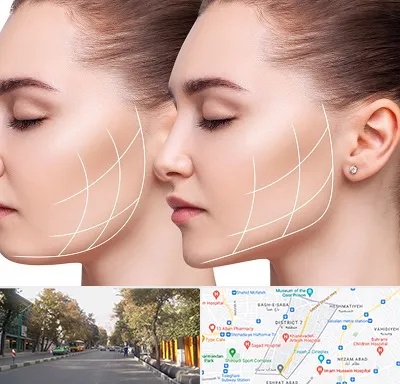 جراحی بوکال فت در شریعتی 