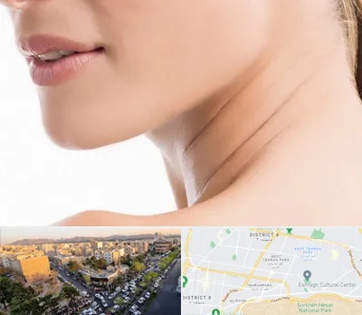 جراحی فک با لیزر در تهرانپارس 