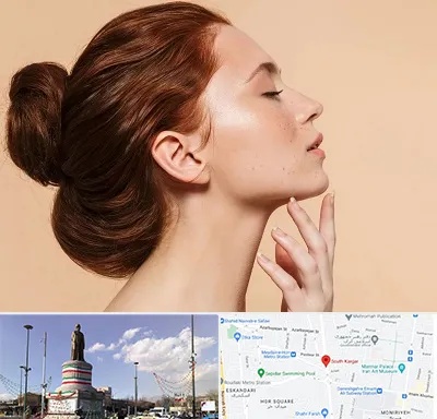 جراحی غبغب در کارگر جنوبی 