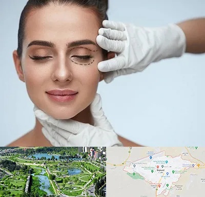 عمل پف چشم در بجنورد