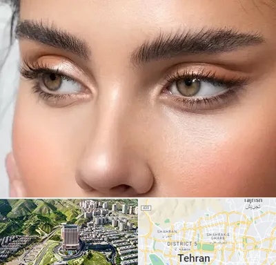 کانتو پلاستی در شمال تهران 