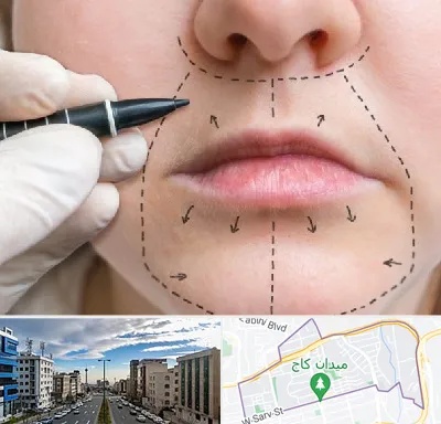 عمل سانترال لب در سعادت آباد 