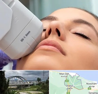 هایفوتراپی در چالوس