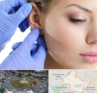 اتوپلاستی در فردیس کرج 