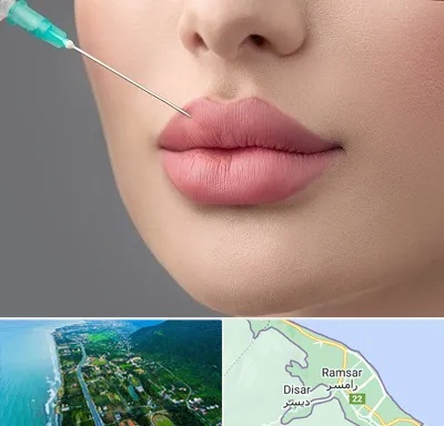 کلینیک ژل لب روسی در رامسر