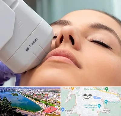 هایفوتراپی در لاهیجان