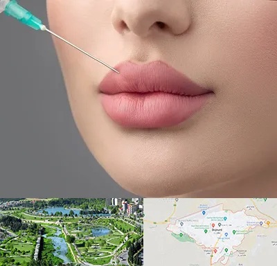 کلینیک ژل لب روسی در بجنورد