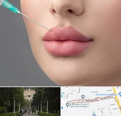 کلینیک ژل لب روسی در بلوار معلم رشت 