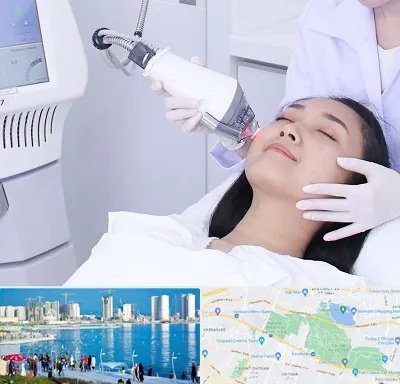 وایتنینگ در چیتگر 