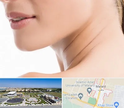 جراحی فک با لیزر در ملارد