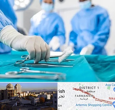 مونس پلاستی در فرمانیه 