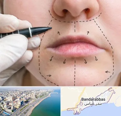 عمل سانترال لب در بندرعباس