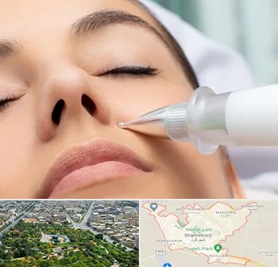 پلاسما جت بینی در شهرکرد
