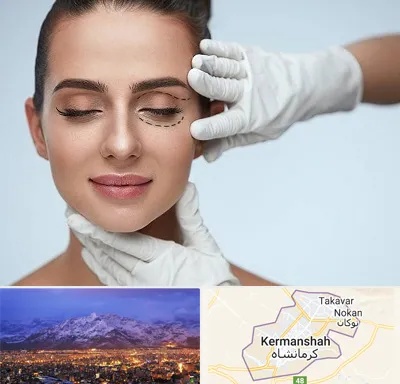 عمل پف چشم در کرمانشاه