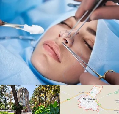 عمل ترمیمی بینی در نیشابور