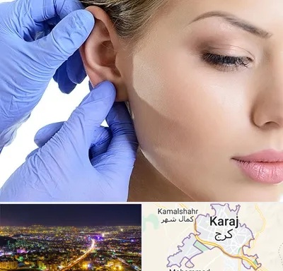 اتوپلاستی در کرج