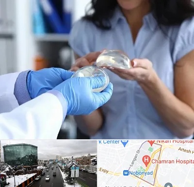 پروتز باسن در اقدسیه 