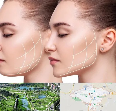 جراحی بوکال فت در بجنورد