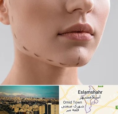 عمل زاویه فک در اسلامشهر