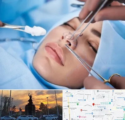 عمل ترمیمی بینی در میدان حر 
